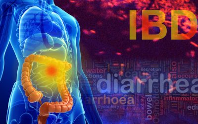 Malattie Infiammatorie Croniche Intestinali (IBD)